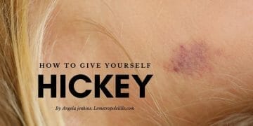 how to give yourself a hickey